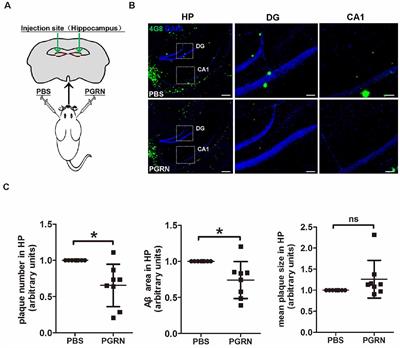 Progranulin Administration Attenuates β-Amyloid Deposition in the Hippocampus of 5xFAD Mice Through Modulating BACE1 Expression and Microglial Phagocytosis